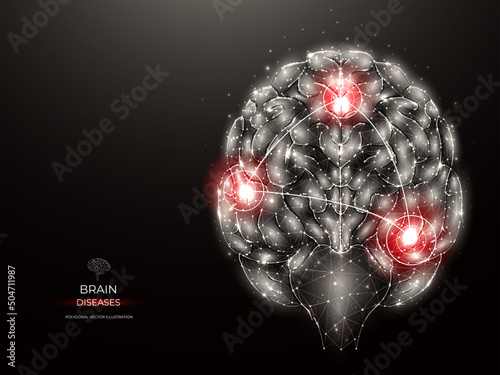 Polygonal illustration of human brain inflammatory disease on a dark background. Cerebrum low poly art. Diseases of the nervous system medical banner, template or background.