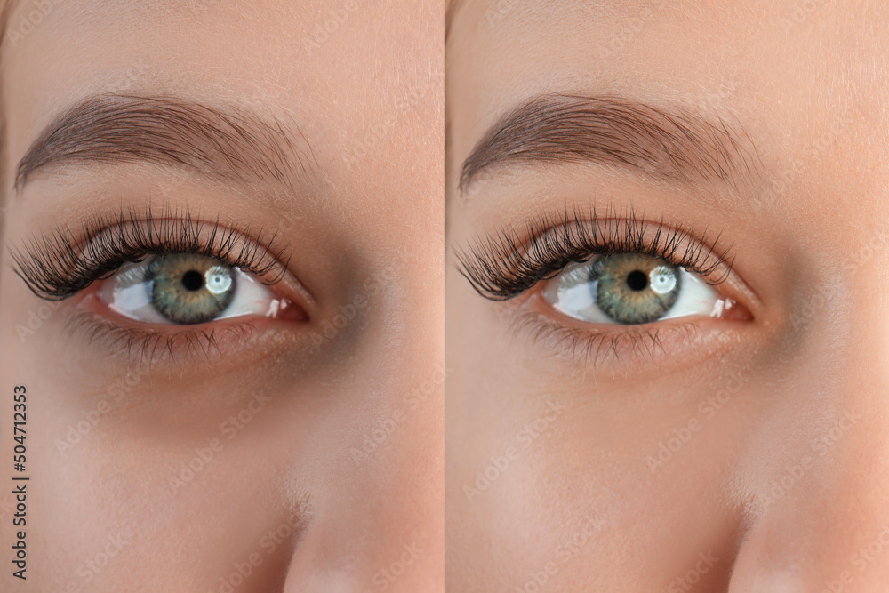 Obraz premium Collage with photos of tired woman with dark circle under eye and after rest, closeup