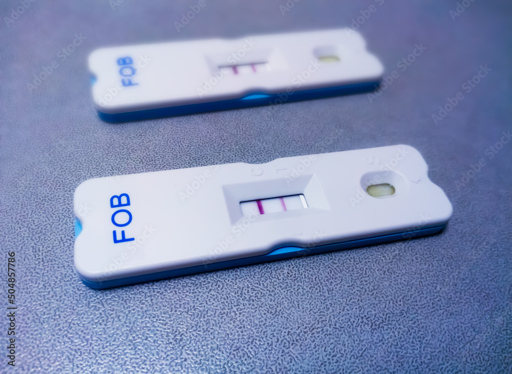 Fecal Occult Blood Test (FOBT) Negative By Using Rapid Test Cassette ...