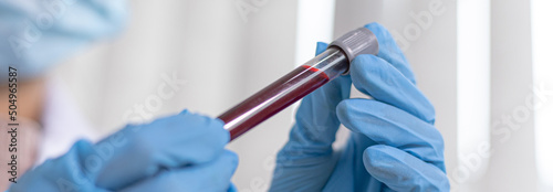 Scientists are testing antiretroviral drugs from the blood of infected patients in order to analyze antibiotics for normal treatment, Testing antiretroviral drugs or pathogens concept. photo