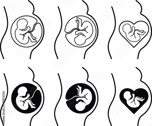Diagram of Pregnant Woman & Infant Clipart Set - Outline and Silhouette