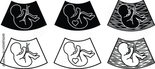 Baby Sonogram Diagram Clipart Set - Outline and Silhouette