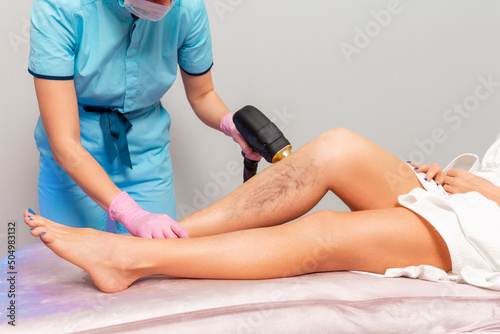A cosmetologist does laser hair removal on woman's legs with varicose veins. Legs close-up. The concept of laser hair removal and varicose veins