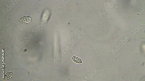 Micro organism ciliate moving photo