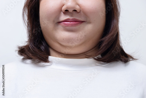 Front View of Woman with her fat second chin photo