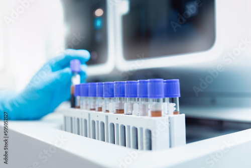 Fotografie Macro photo hand of medical worker, Biochemical analyzer blood tests on modern e