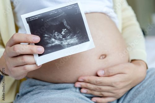 Asian pregnant woman holding ultrasound film scan of baby