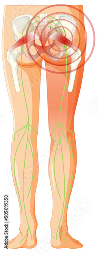 Lower back suffering from ankylosing spondylitis
