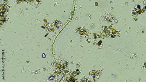 nematode in compost, in soil under the microscope	 photo