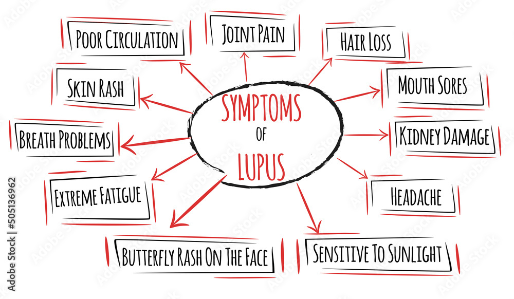 Common lupus symptoms. List of human organs damaged by lupus syndrome.