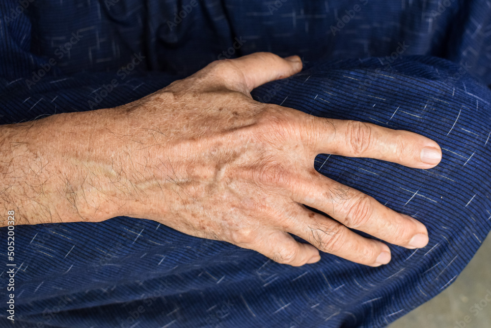Fototapeta premium Hand of Asian elder man. Concept of rheumatoid arthritis, osteoarthritis, or joint pain