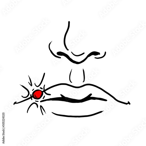 Herpes vector illustration isolated on white background