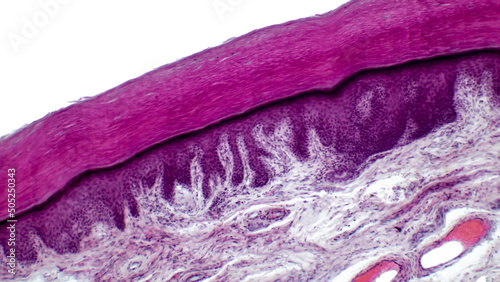 Human skin. Light micrograph of epithelial tissue from the skin. Human finger section showing epidermis (stratified squamous epithelium), dermis and connective tissues.  H&E stain. photo