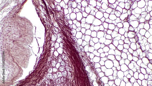 Obraz na plátne Light micrograph of subcutaneous adipose tissue