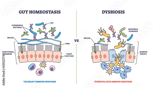 Gut homeostasis and dysbiosis immune response differences outline diagram. Labeled educational scheme with functional barrier and defect side view vector illustration. Tolerant and dysregulated flora. photo