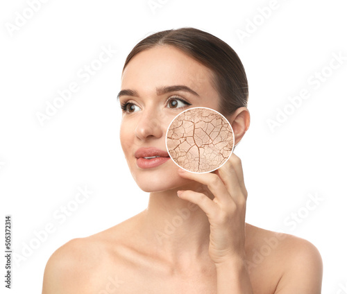 Fotografering Young woman with facial dry skin problem on white background
