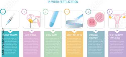 In vitro fertilization procedure infographic