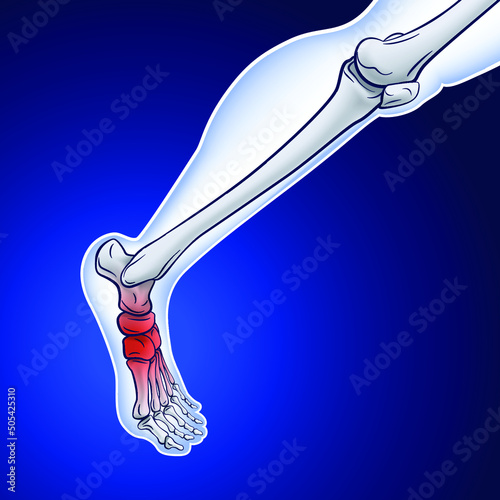 An illustration of a running skeletal line showing a red dot indicating an injury. medical use educational and scientific