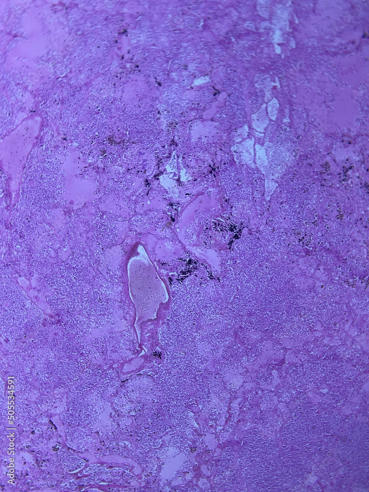 Φωτογραφία Lung tissue histology isolated
