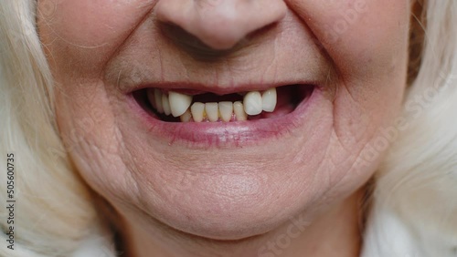 Close-up macro shot of toothless female smile mouth of senior elderly woman. Dental problem, bad teeth loss. Pensioner lady showing his rotten teeth, caries, decayed and weak enamel, teeth falling out photo