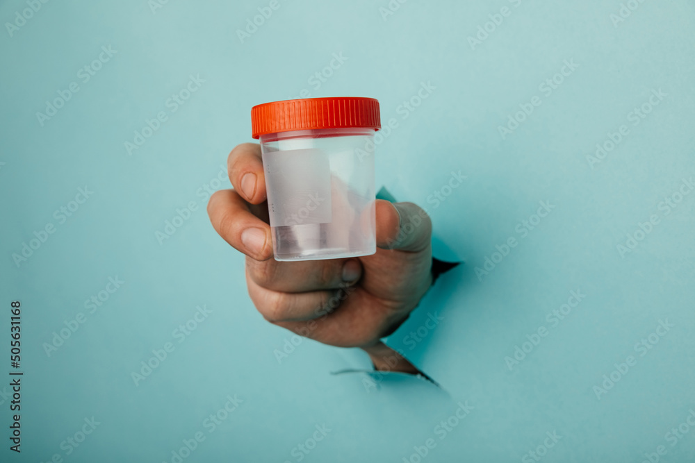 Male hand holds a plastic jar for urine tests, the hand is sticking out of a torn hole in a blue background - obrazy, fototapety, plakaty 