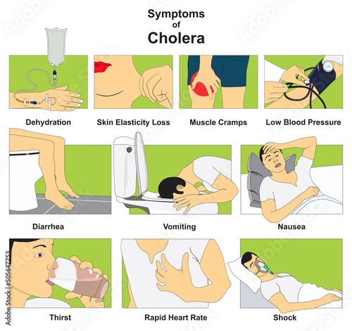 Symptoms of cholera epidemic infectious disease infographic diagram diagnosis signs for medical science education illness cartoon vector drawing chart illustration scheme physical examination test photo