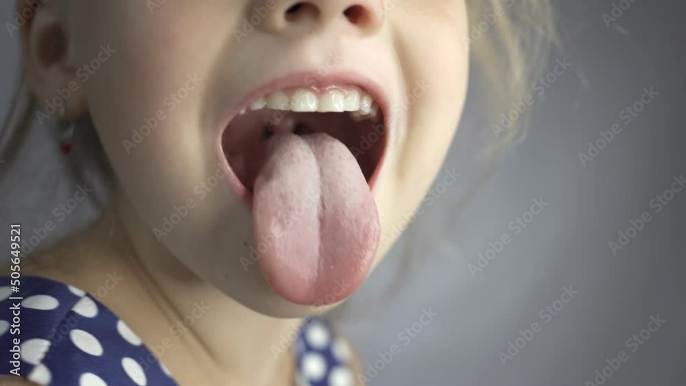 kid salivation girl opens her mouth child shows his teeth soft ...