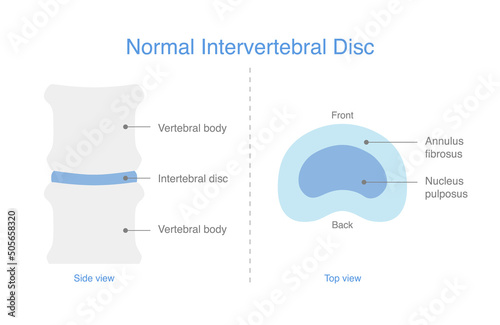 Schematic representations of the normal intervertebral disc. Illustration of medical diagram for the bone spine.
