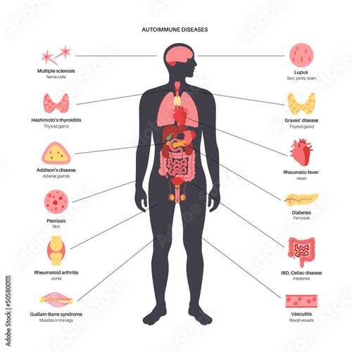 Autoimmune disorders diseases
