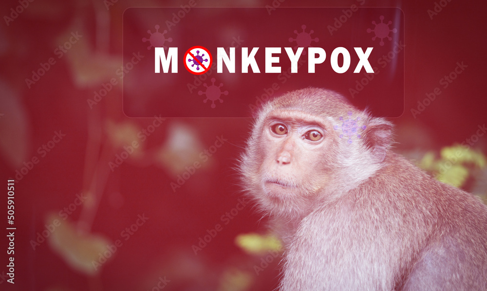 Monkeypox outbreak concept. Monkeypox is caused by monkeypox virus. Monkeypox is a viral zoonotic disease. Virus transmitted to humans from animals. Monkeys may harbor the virus and infect people. - obrazy, fototapety, plakaty 