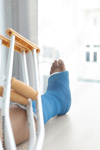 Blue ankle and foot splint Bandages on the legs from a young man's fall accident, Blue plaster on the ankle, Crutches assist in the walking of the patient.