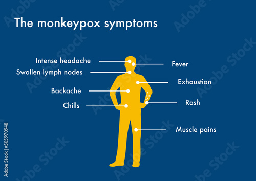 The main symptoms of monkeypox disease photo