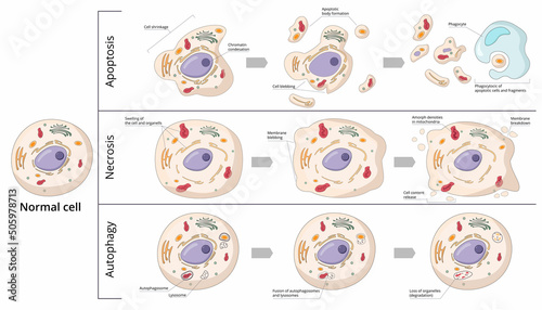 Three basic forms of cell death: apoptosis (chromosome condensation, nuclear fragmentation), autophagy (autophagosome formation), necrosis (membrane rupture, organelles swelling).  © Olha