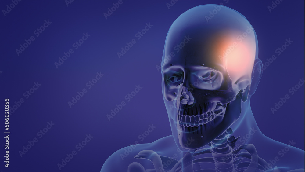 Animation of a painful Headache Animation of a painful Headache