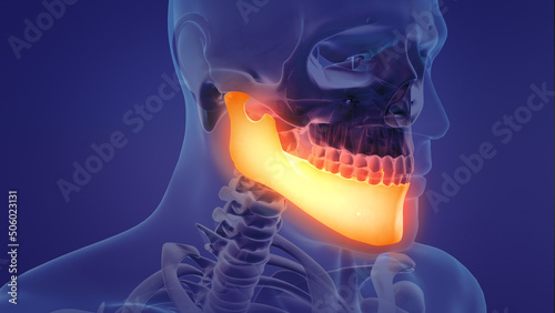 Tableau sur toile Animation of a painful mandible