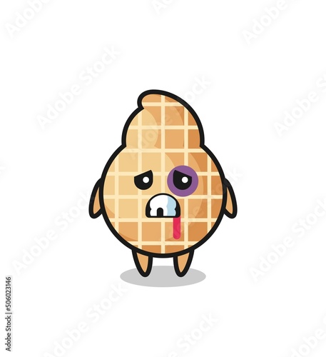 injured peanut character with a bruised face