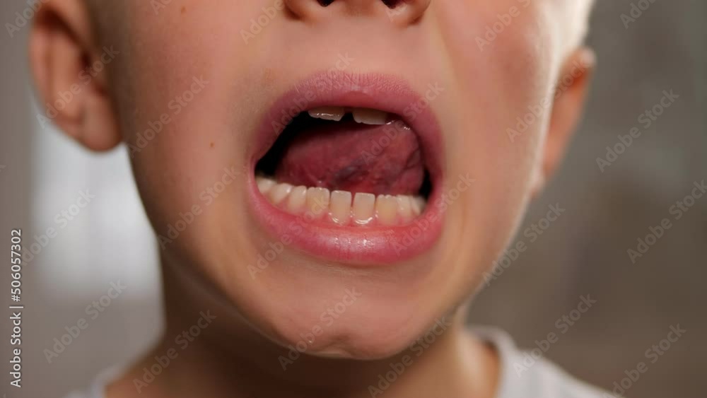 A close-up of a little boy's face with his mouth open, he shows his changing teeth. A close-up of a little boy's face with his mouth open, he shows his changing teeth.