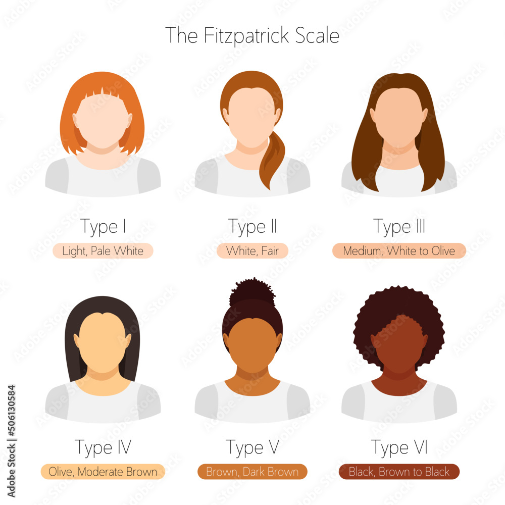 The Fitzpatrick scale. Women with different skin tone, hair and eyes color.  Flat vector illustrations isolated on white Stock Vector