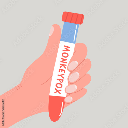 Hand hold test tube with blood for Monkeypox virus test. Modern flat vector isolated illustration in trendy colors