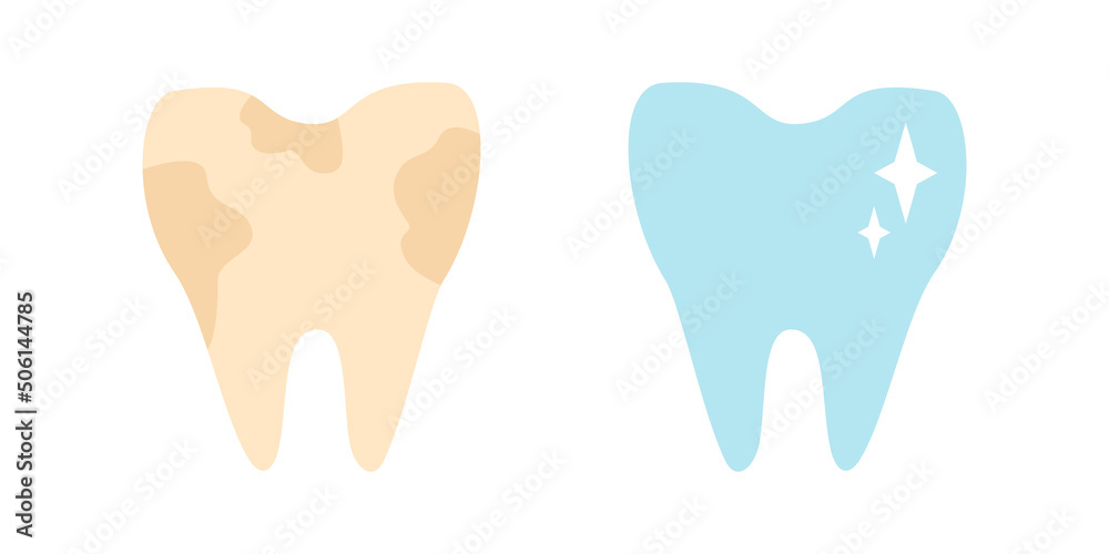 Vector set icons of dirty teeth and white tooth. Vector illustration of teeth stomatology. Vector set icons of dirty teeth and white tooth. Vector illustration of teeth stomatology.
