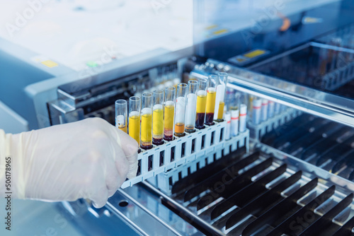 Scientist nurse downloads blood test samples to dna, hiv, aids, Coronavirus on analysis laboratory