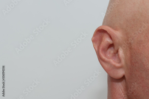 .A bulge on the auricle of a human Darwin's tubercle, or Darwin's tubercle photo Fototapet