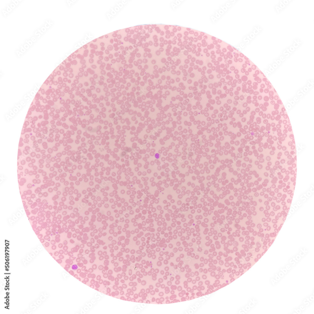 Red blood cells in blood smear on white background. Red blood cells in blood smear on white background.