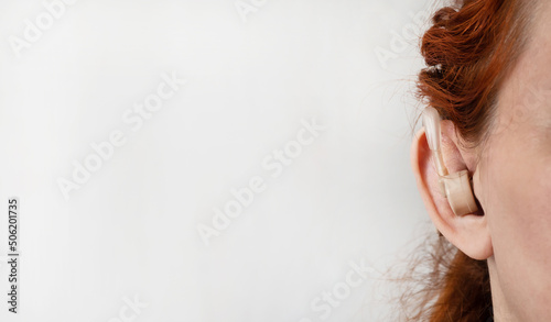 Hearing aid. Close-up of a girl with a hearing aid in her ears. photo
