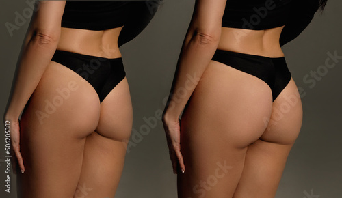 Εκτύπωση καμβά Perfect female shape of buttocks and hips after diet, fitness sports and tanning
