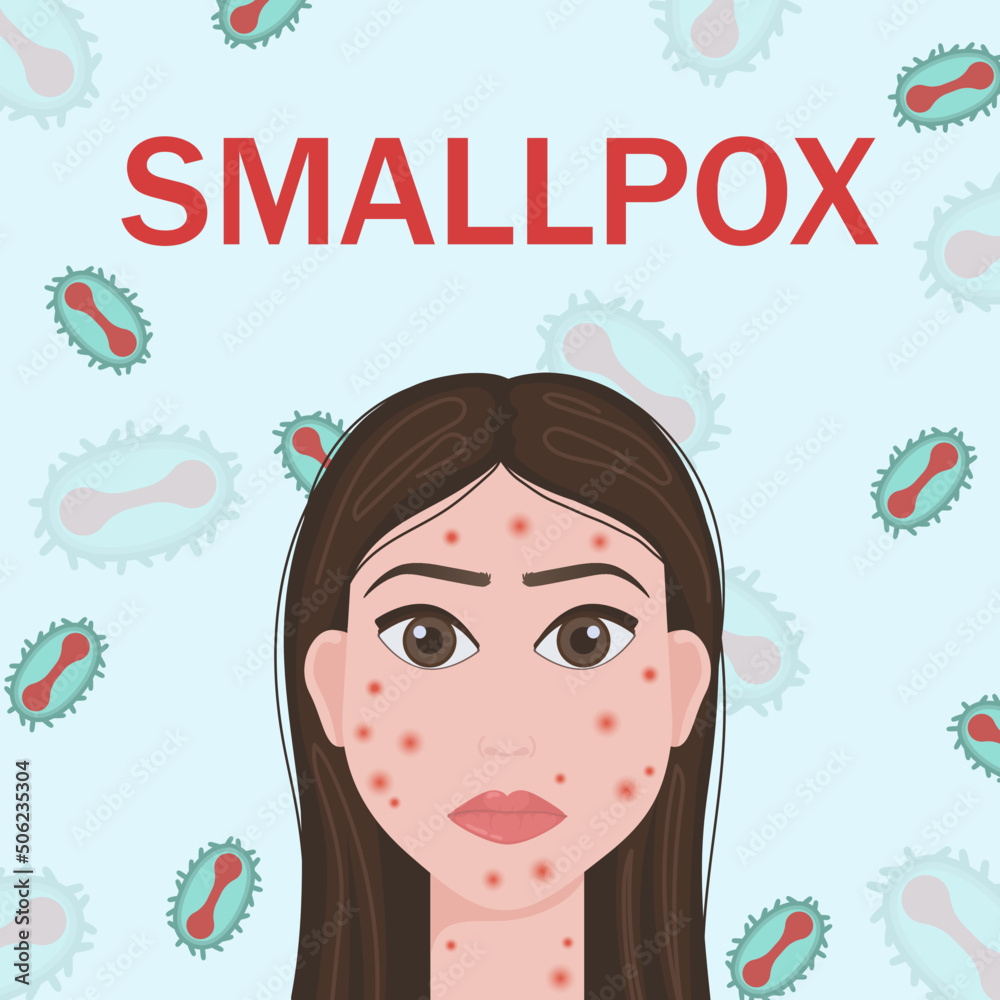 Smallpox virus. Vector illustration of smallpox virus. Monkeypox. Vector illustration of a person affected by smallpox. Smallpox virus. Vector illustration of smallpox virus. Monkeypox. Vector illustration of a person affected by smallpox.