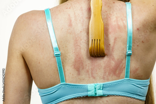 Woman scratching her itchy back using scratcher photo