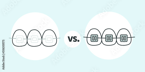 Ceramic Braces Vs Metal Braces, Orthodontist vector illustrator