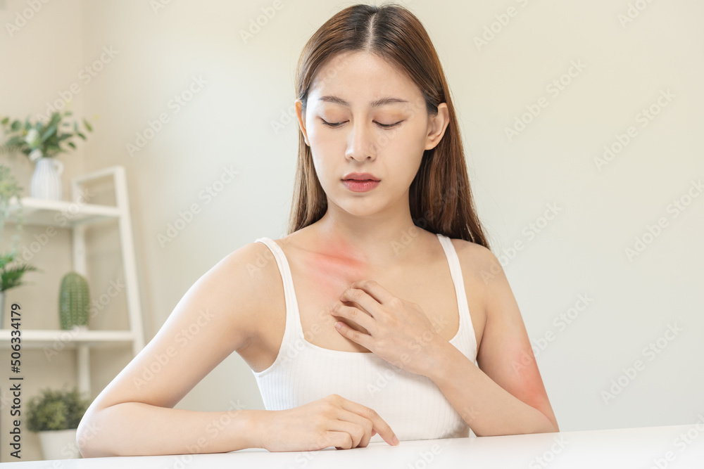 Dermatology, asian young woman, girl allergy, allergic reaction from atopic, insect bites on her body, hand in scratching itchy, itch red spot or rash of skin. Healthcare, treatment of beauty. Dermatology, asian young woman, girl allergy, allergic reaction from atopic, insect bites on her body, hand in scratching itchy, itch red spot or rash of skin. Healthcare, treatment of beauty.