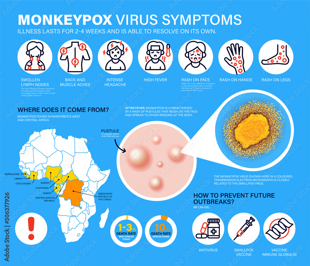 Monkeypox virus Symptoms. New cases of Monkeypox virus are reported in Europe and USA. Monkeypox is spreading in the Europe. It cause skin infections. Monkeypox virus detailed infographics - obrazy, fototapety, plakaty 